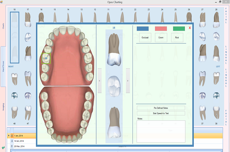 Dental Software System Electronic Charting
